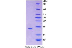 SDS-PAGE analysis of Human Hemoglobin alpha 1 Protein. (HBA1 蛋白)