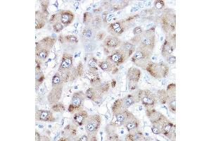 Immunohistochemistry of paraffin-embedded human liver using BAAT Rabbit pAb (ABIN6131367, ABIN6137411, ABIN6137412 and ABIN6223563) at dilution of 1:500 (40x lens).
