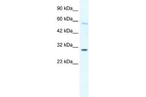 WB Suggested Anti-GATAD1 Antibody Titration: 0. (GATAD1 抗体  (C-Term))