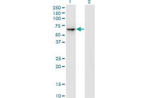Western Blot analysis of ZNF350 expression in transfected 293T cell line by ZNF350 monoclonal antibody (M01), clone 1A9. (ZNF350 抗体  (AA 1-532))