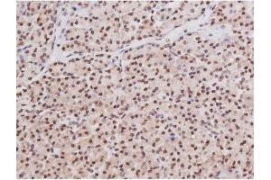 ABIN6267354 at 1/200 staining Human pancreas tissue sections by IHC-P. (MAPT 抗体  (pSer235))