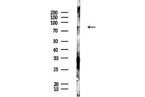 Western blot analysis of lysates from PC12 cells, using K6PL Antibody at 1/1000 dilution.