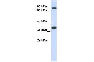 RRP1B antibody used at 1 ug/ml to detect target protein. (RRP1B 抗体)
