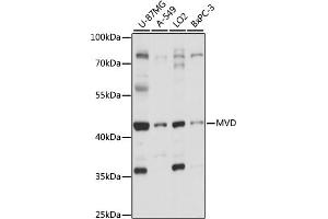 Western blot analysis of extracts of various cell lines, using MVD antibody (ABIN7268505) at 1:1000 dilution. (MVD 抗体  (AA 1-270))