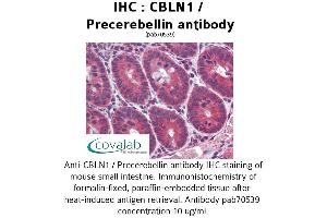 Image no. 2 for anti-Cerebellin 1 Precursor (CBLN1) antibody (ABIN1732717) (CBLN1 抗体)