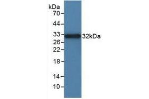 Western blot analysis of recombinant Rat ITGaD. (ITGAD 抗体  (AA 879-1099))