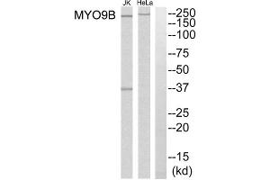 Western blot analysis of extracts from HeLa cells and Jurkat cells, using MYO9B antibody. (MYO9B 抗体  (N-Term))
