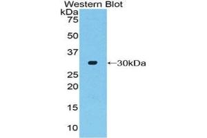 Western Blotting (WB) image for anti-Adenylate Cyclase 2 (Brain) (ADCY2) (AA 294-525) antibody (ABIN1857908)