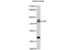 Western blot analysis of extracts of mouse brain, using DBH antibody (ABIN1872202) at 1:1000 dilution. (DBH 抗体)