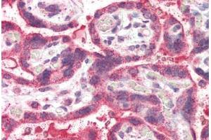 Human Placenta (formalin-fixed, paraffin-embedded) stained with NEIL1 antibody ABIN337008 at 5 ug/ml followed by biotinylated anti-goat IgG secondary antibody ABIN481715, alkaline phosphatase-streptavidin and chromogen. (NEIL1 抗体  (AA 378-390))