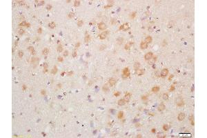 Immunohistochemistry (Paraffin-embedded Sections) (IHC (p)) image for anti-NADH Dehydrogenase (Ubiquinone) 1 alpha Subcomplex, 8, 19kDa (NDUFA8) (AA 101-172) antibody (ABIN751723)
