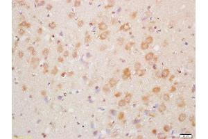 Formalin-fixed and paraffin embedded mouse brain labeled with Rabbit Anti-NDUFA8 Polyclonal Antibody, Unconjugated  at 1:200 followed by conjugation to the secondary antibody and DAB staining (NDUFA8 抗体  (AA 101-172))
