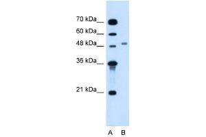 MGAT2 antibody used at 1.
