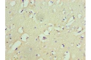 Immunohistochemistry of paraffin-embedded human brain tissue using ABIN7153960 at dilution of 1:100 (Glutamate Receptor 1 抗体  (AA 19-300))