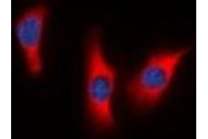 Immunofluorescent analysis of DUSP9 staining in HeLa cells. (DUSP9 抗体)