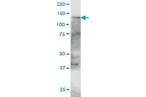ERN1 monoclonal antibody (M05), clone 4E1 Western Blot analysis of ERN1 expression in HeLa . (ERN1 抗体  (AA 401-500))