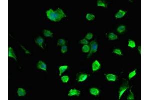 Immunofluorescent analysis of U251 cells using ABIN7149640 at dilution of 1:100 and Alexa Fluor 488-congugated AffiniPure Goat Anti-Rabbit IgG(H+L) (DAZL 抗体  (AA 130-250))