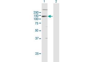 Western Blot analysis of LLGL2 expression in transfected 293T cell line by LLGL2 MaxPab polyclonal antibody. (LLGL2 抗体  (AA 1-1020))