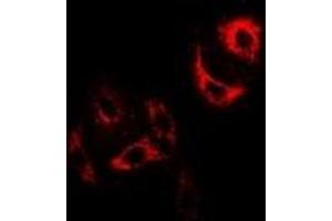 Immunofluorescent analysis of H-FABP staining in U2OS cells. (FABP3 抗体)