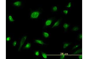Immunofluorescence of monoclonal antibody to AK1 on HeLa cell. (Adenylate Kinase 1 抗体  (AA 1-194))
