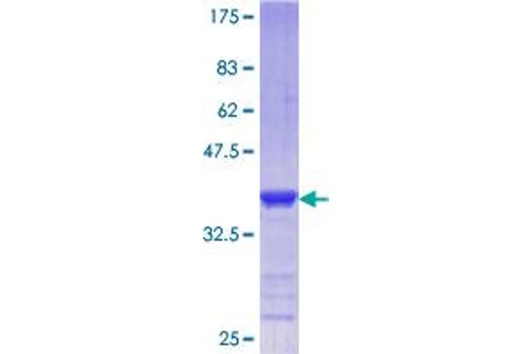PCGF2 Protein (AA 236-294) (GST tag)