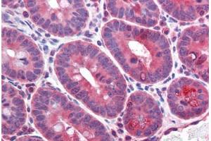 Mouse small intestine: Formalin-Fixed, Paraffin-Embedded (FFPE) (CD36 抗体  (AA 99-114))