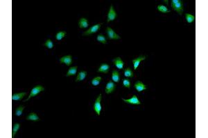 Immunofluorescence analysis of A549 cell using HELLS antibody. (HELLS 抗体)