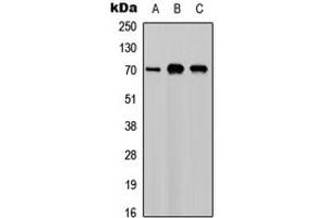 Western blot analysis of M-CSF expression in A549 (A), NS-1 (B), PC12 (C) whole cell lysates. (M-CSF/CSF1 抗体  (C-Term))