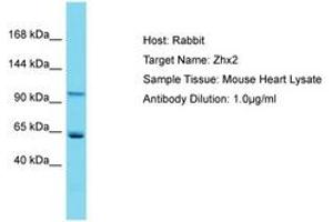 Image no. 1 for anti-Zinc Fingers and Homeoboxes 2 (ZHX2) (AA 703-752) antibody (ABIN6750296) (ZHX2 抗体  (AA 703-752))