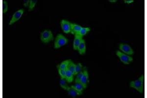 Immunofluorescence staining of HepG2 cells with ABIN7160289 at 1:200, counter-stained with DAPI. (MUC2 抗体  (AA 569-657))