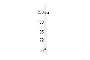 Western Blotting (WB) image for anti-Collagen, Type V, alpha 1 (COL5A1) (AA 54-82), (N-Term) antibody (ABIN5530939)