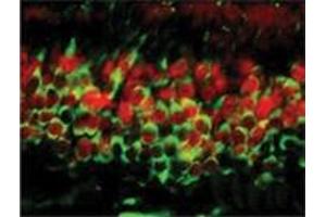 Image no. 1 for anti-DNA (Cytosine-5-)-Methyltransferase 3 alpha (DNMT3A) (AA 705-908), (C-Term) antibody (ABIN207958) (DNMT3A 抗体  (C-Term))