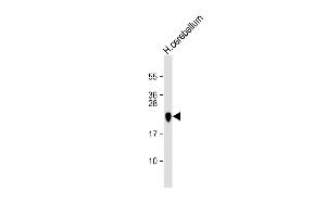 Anti MBP Antibody  at 1:16000 dilution + human cerebellum lysate Lysates/proteins at 20 μg per lane. (MBP 抗体  (AA 177-209))