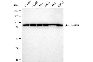 Western blotting analysis using Hsp90 beta antibody (ABIN7798873).