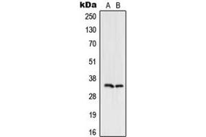 Western blot analysis of UDG expression in HeLa (A), Jurkat (B) whole cell lysates. (UDG (Center) 抗体)