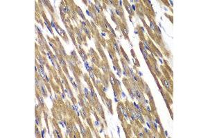 Immunohistochemistry (Paraffin-embedded Sections) (IHC (p)) image for anti-Succinate Dehydrogenase Complex, Subunit A, Flavoprotein (Fp) (SDHA) (AA 385-664) antibody (ABIN3023400)