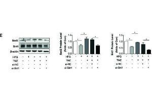 Western Blotting (WB) image for anti-Sirtuin 1 (SIRT1) (AA 448-747) antibody (ABIN6147784)