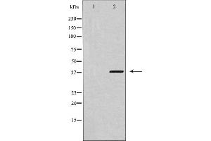 Western blot analysis of CXCR4 expression in K562 cells,The lane on the left is treated with the antigen-specific peptide. (CXCR4 抗体  (C-Term))