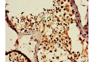 IHC image of ABIN7150995 diluted at 1:600 and staining in paraffin-embedded human testis tissue performed on a Leica BondTM system. (CBL 抗体  (AA 548-847))