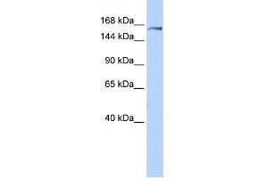 WB Suggested Anti-EPRS Antibody Titration:  0. (EPRS 抗体  (Middle Region))