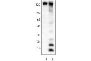Image no. 1 for anti-Acetylated Lysine antibody (ABIN300042) (Acetylated Lysine 抗体)