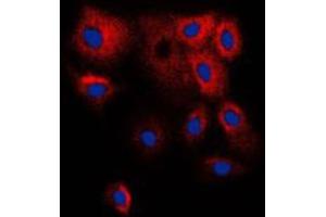 Immunofluorescent analysis of Cytochrome P450 2B6 staining in HepG2 cells. (CYP2B6 抗体  (Center))