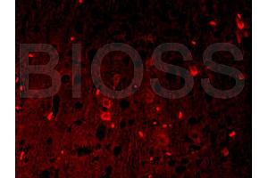 Formalin-fixed and paraffin-embedded rat brain labeled with Anti-? (beta Catenin 抗体  (AA 661-781))