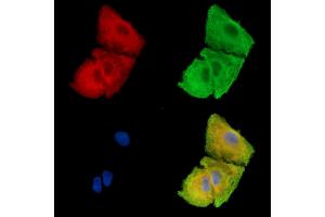 ABIN7096231 and ABIN7100293 staining  cells by IF/ICC. (FAM83H 抗体)
