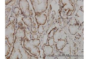 Image no. 1 for anti-Suppressor of Cytokine Signaling 5 (SOCS5) (AA 1-110) antibody (ABIN599092) (SOCS5 抗体  (AA 1-110))