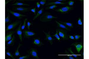 Immunofluorescence of purified MaxPab antibody to AK3L1 on HeLa cell. (AK4 抗体  (AA 1-223))
