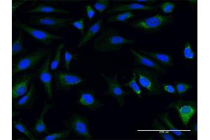 Immunofluorescence of purified MaxPab antibody to AK3L1 on HeLa cell. (AK4 抗体  (AA 1-223))