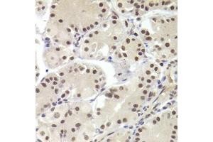 Immunohistochemistry of paraffin-embedded human stomach using RBPJ Antibody. (RBPJ 抗体)