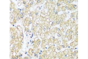 Immunohistochemistry of paraffin-embedded Human liver using ATP5I Polyclonal Antibody at dilution of 1:100 (40x lens). (ATP5I 抗体)