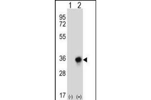Western blot analysis of CBR3 (arrow) using rabbit polyclonal CBR3 Antibody (C-term) (ABIN656808 and ABIN2846022). (CBR3 抗体  (C-Term))